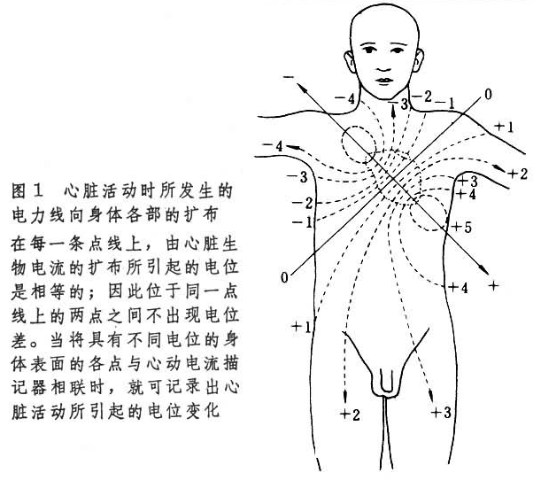 心电图