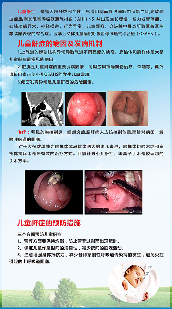 关注孩子的鼾声――儿童鼾症