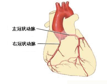 冠脉造影