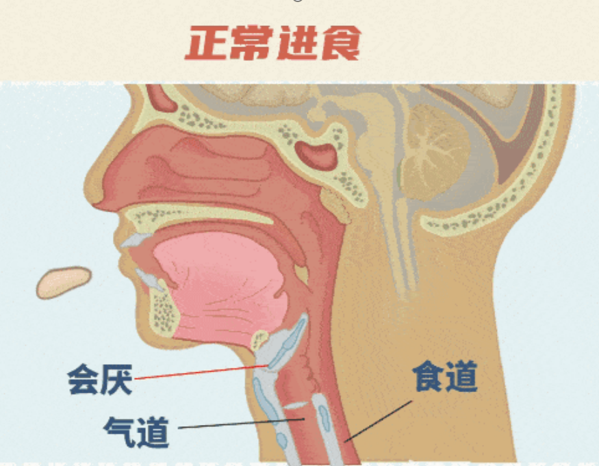 就诊到去世仅10分钟！医生：这种嗓子疼很危险