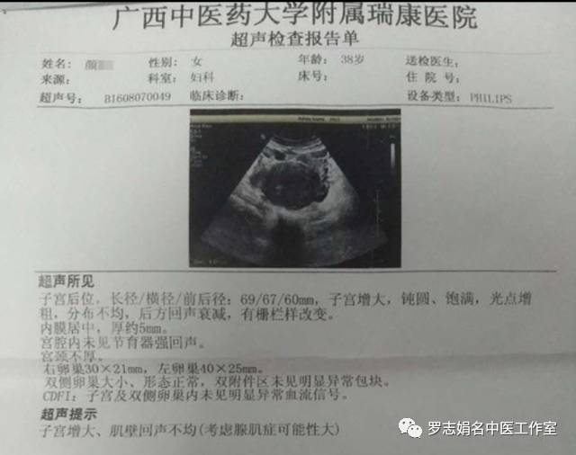 罗志娟教授治疗子宫腺肌病引发痛经、不孕症经验