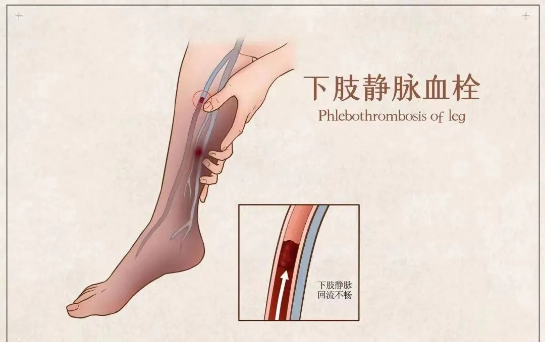 【针对术后】术后需卧床，如何躺着运动促进康复？带示范视频哦~