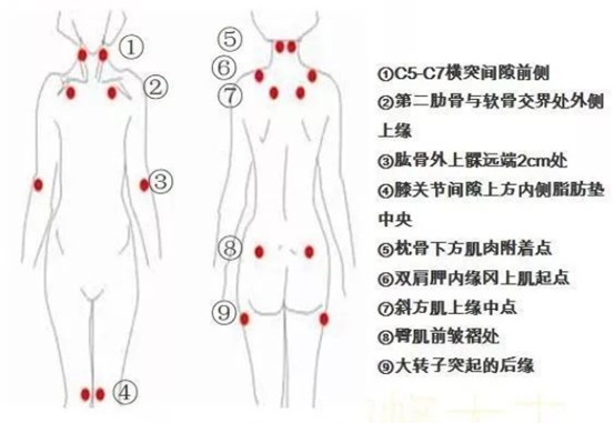 不容忽视的“纤维肌痛综合征”